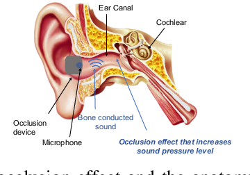 Earmonitor: In-ear Motion-resilient Acoustic Sensing using Commodity Earphones