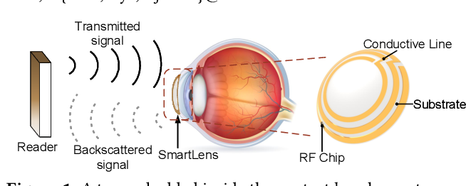 SmartLens: Sensing Eye Activities Using Zero-power Contact Lens